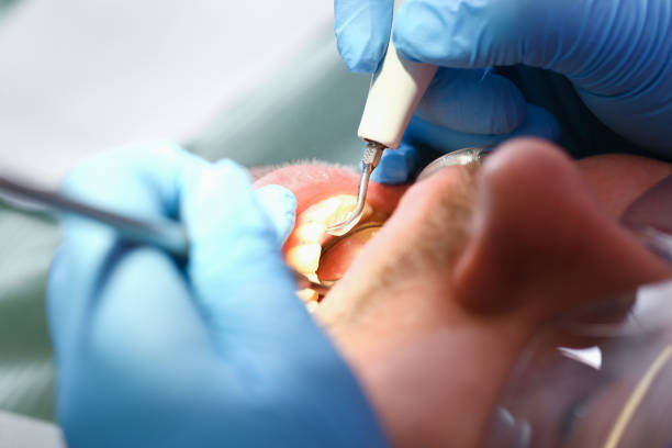 Best Emergency Denture Repair in Bridgeport, TX
