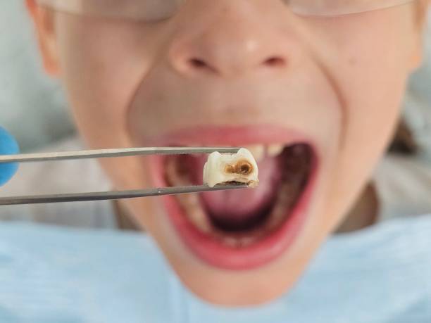 Best 24-Hour Emergency Dentist in Bridgeport, TX